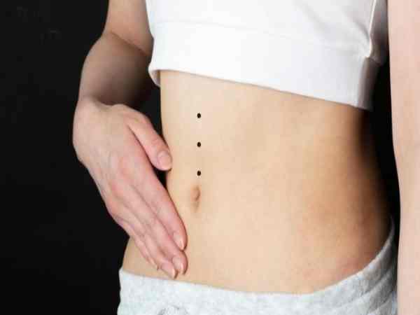 Nốt ruồi ở bụng phải nữ giới