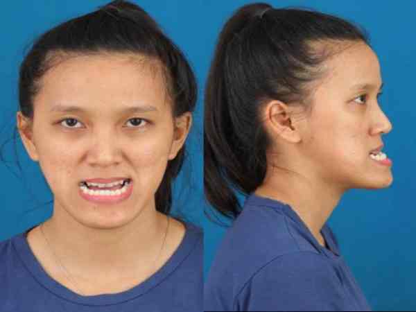  Ý nghĩa tướng mặt lưỡi cày đối với phụ nữ