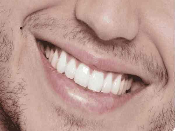 Giải mã ý nốt ruồi khóe miệng nam nữ vận số tốt hay xấu?