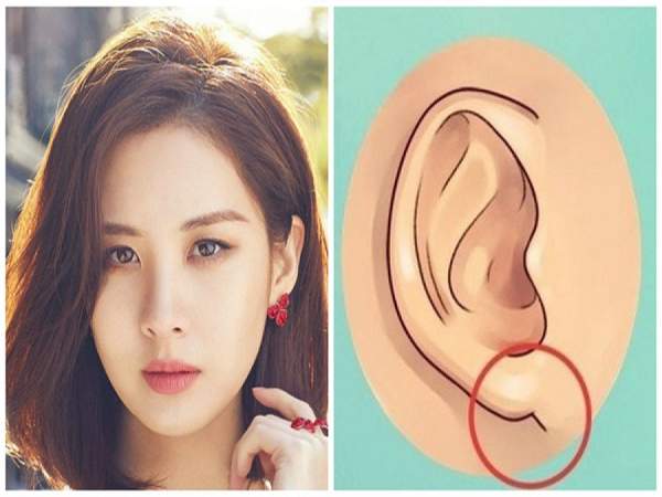 Mặt quắt tai dơi là gì? 