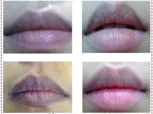 Vận mệnh nam giới môi thâm