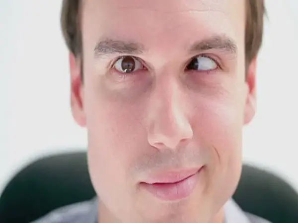  Mắt lé kim ở nam giới