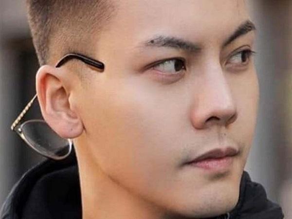 Nốt ruồi ở lông mày phải nam