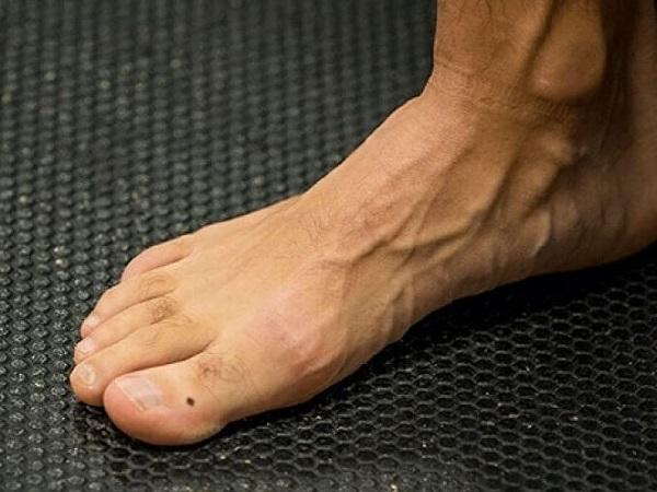 So sánh ý nghĩa giữa nam và nữ có mụn ruồi ở ngón chân cái