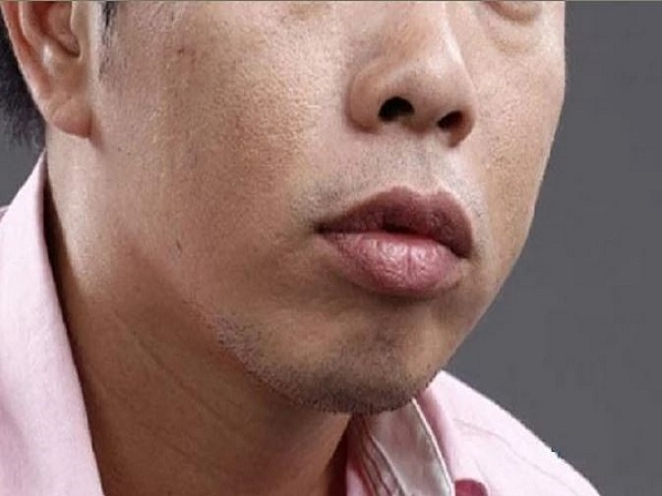 Tướng đàn ông môi trề